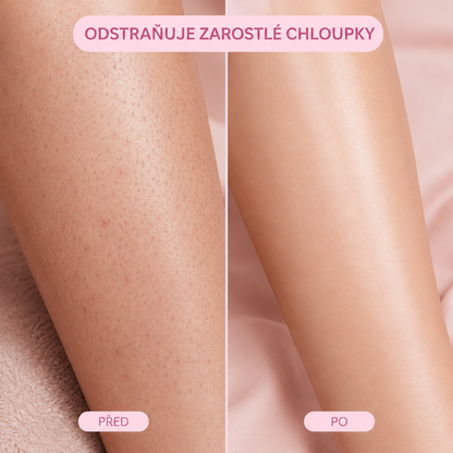 Elure: Krystalkový Odstraňovač Chloupků