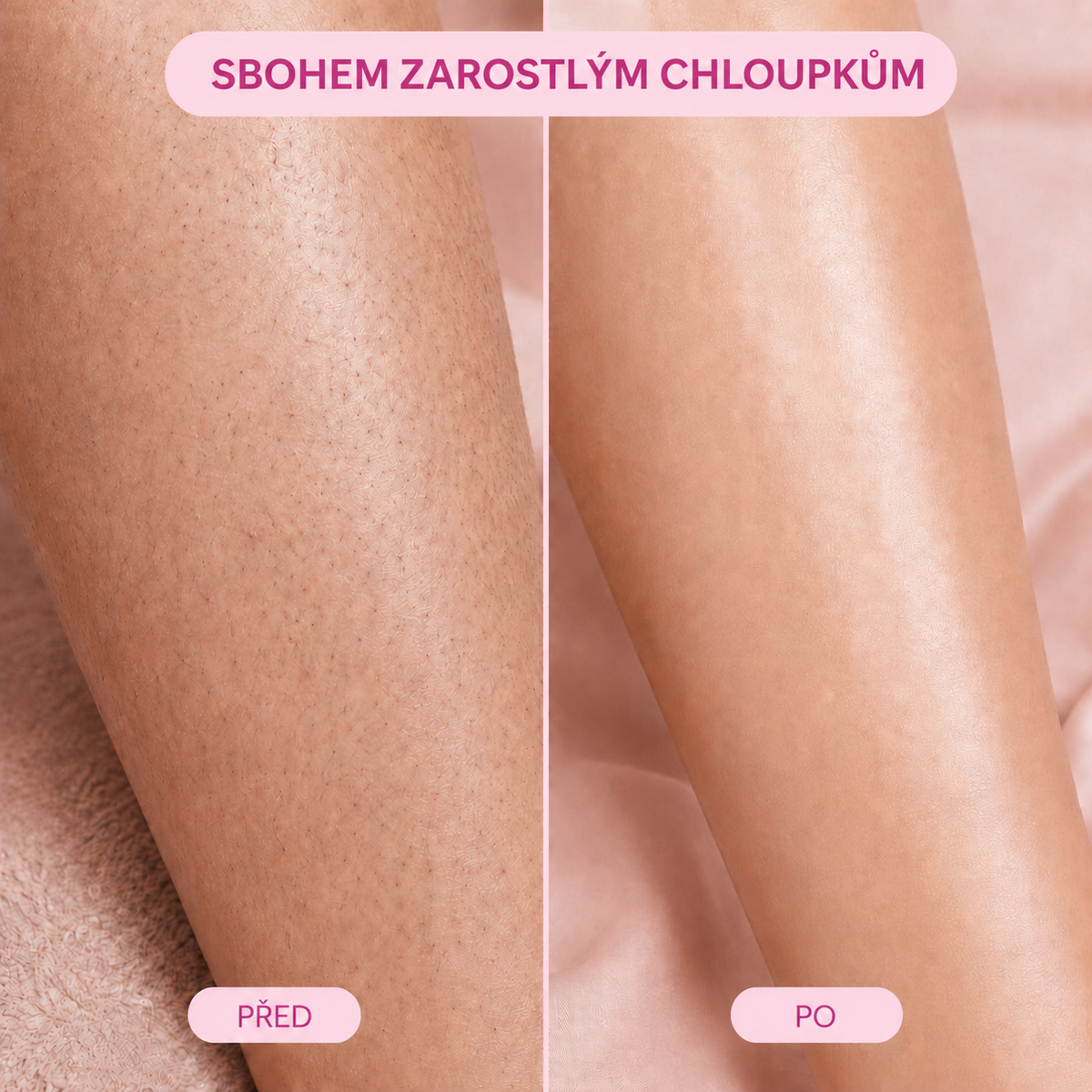 Elure: Krystalkový Odstraňovač Chloupků